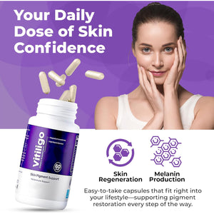 Vitiligo Capsules 60 Count | 1 Month | Improve Skin Pigmentation Support and Reduce White Spots | Effective Vitiligo Supplement | Natural Solution for White Spots on Skin. (1)