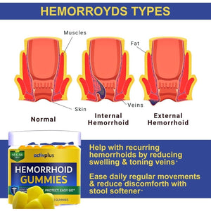 Hemorrhoid Treatment to Reduce Re-Occurrences & Easier Regularity with Stool Softener | 7 Clinically Studied Hemorrhoid Ingredients | Plant-Based Sugar Free Lemon 60 Vegan Gummies