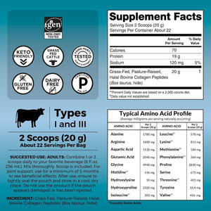 Viva Naturals Collagen Peptides Powder - Grass-Fed Hydrolyzed Bovine, Type I & III - 19 G Protein, Unflavored, Easy Dissolving - Joint, Skin, Hair & Nail Support - Paleo, Keto, Non-Gmo - 1Lb
